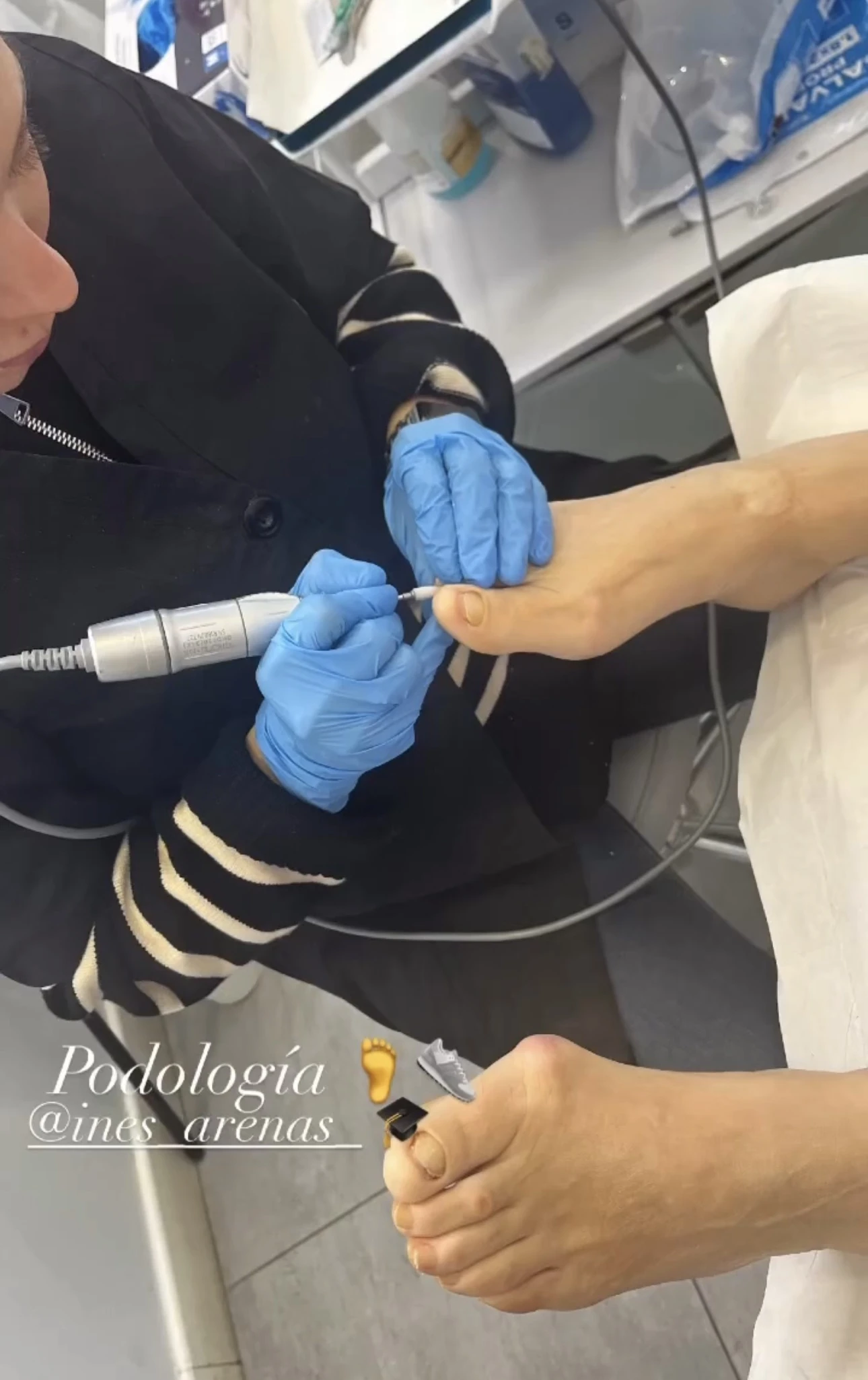 Tratamiento de podología
